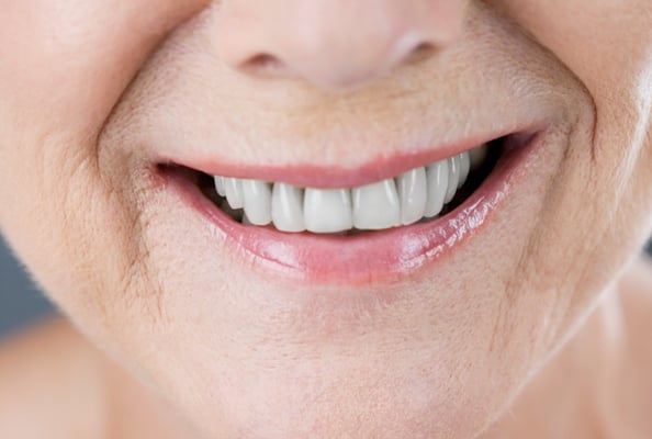 teeth generic woman