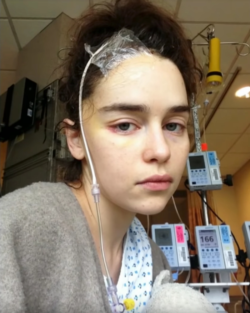 Emilia Clarke brain surgery 